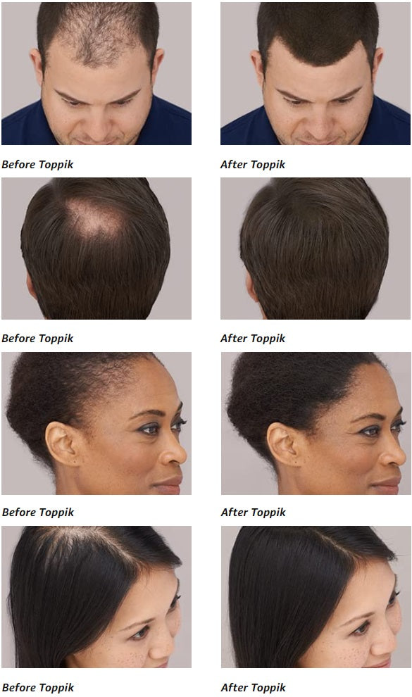 Hair Building Natural Keratin Fibers【Flash Sale!】